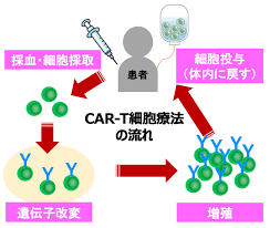 CAR-T細胞療法の流れ